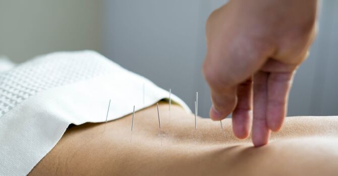 BE Acupuncture + Customized Herbal Prescription