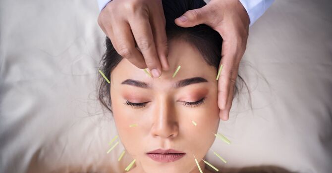BE Acupuncture